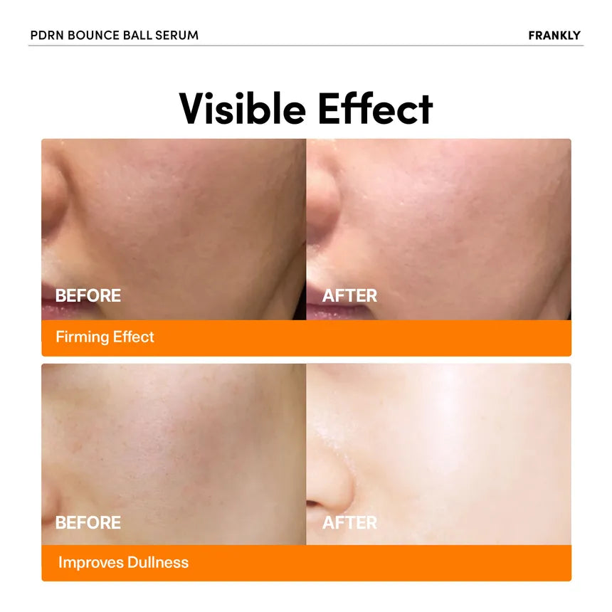 FRANKLY - PDRN Bounce Ball Serum